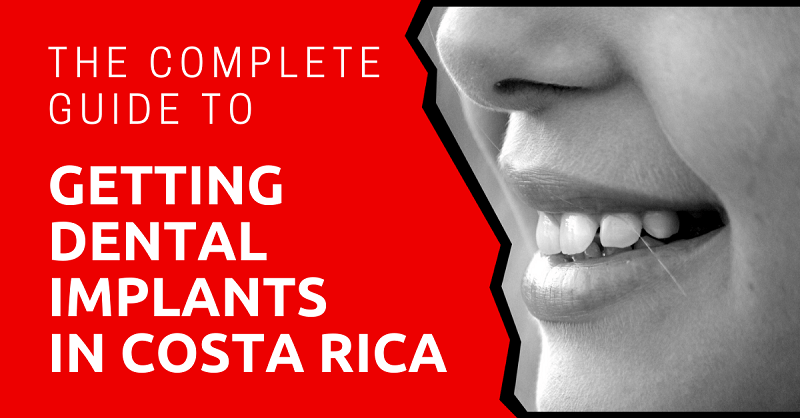 The-Complete-Guide-to-Getting-Dental-Implants-in-Costa-Rica
